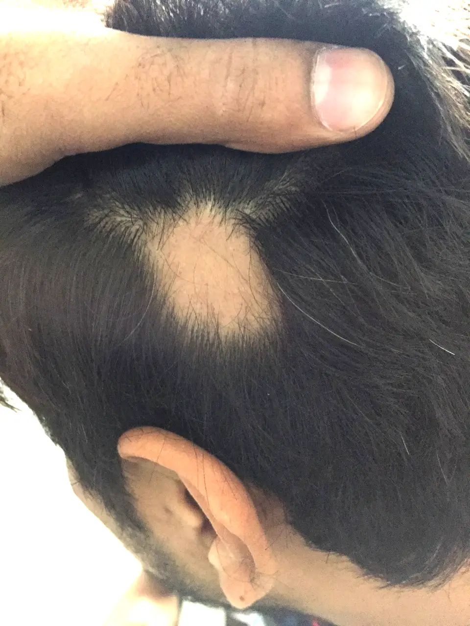 Hair Issue Before 2