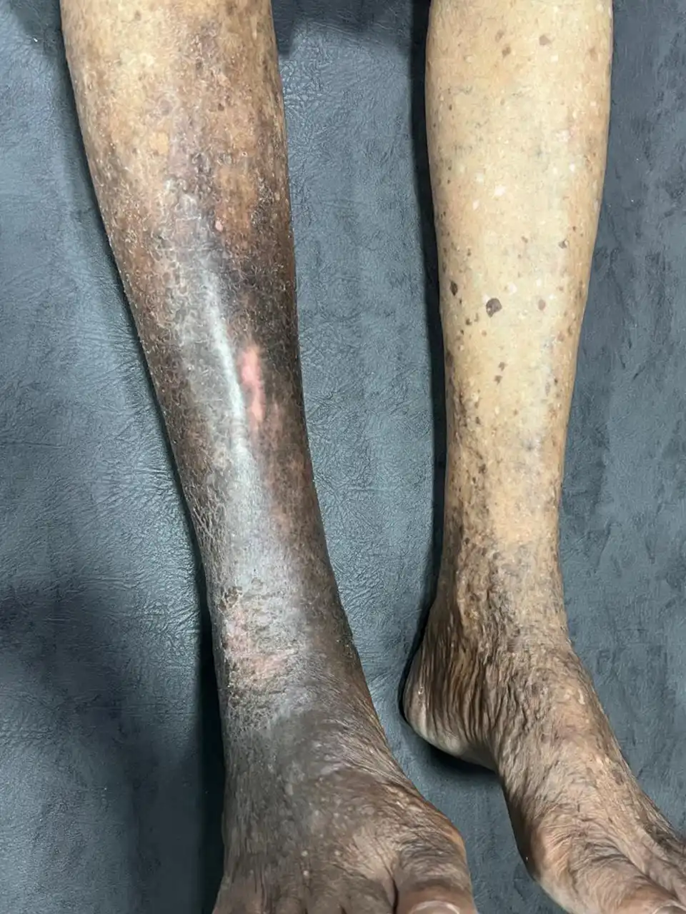 10 After Leg Problem