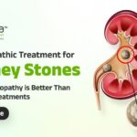 Homeopathic treatment for Kidney Stones. Try Natural Help at Satva Homeopathy Clinic