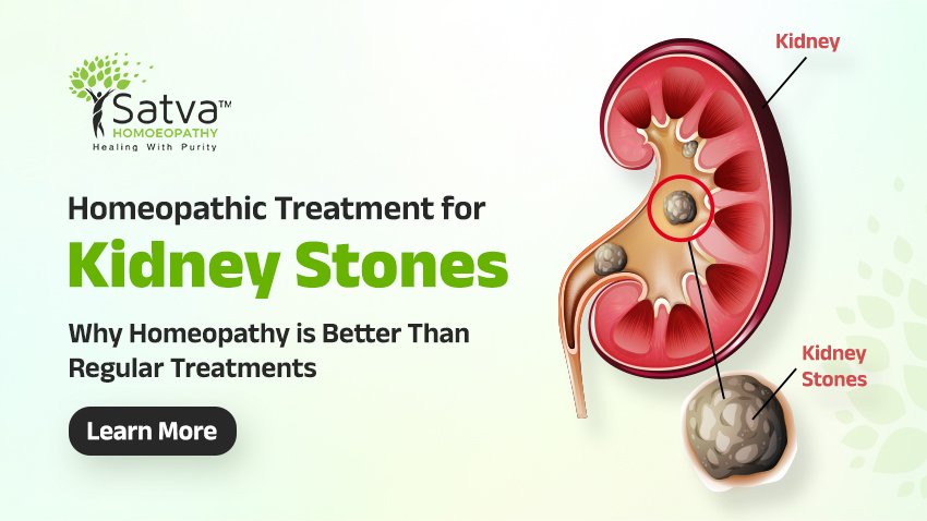 Homeopathic treatment for Kidney Stones. Try Natural Help at Satva Homeopathy Clinic